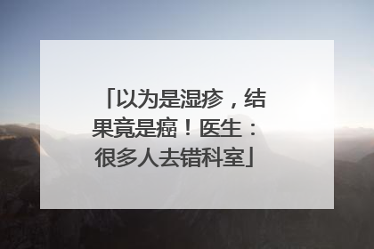以为是湿疹，结果竟是癌！医生：很多人去错科室